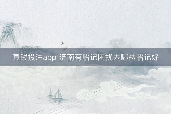 真钱投注app 济南有胎记困扰去哪祛胎记好