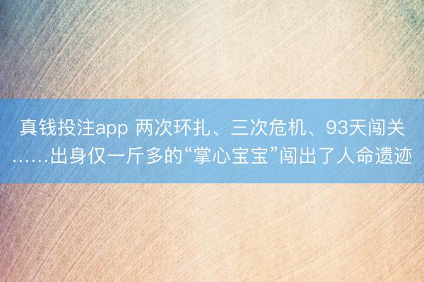真钱投注app 两次环扎、三次危机、93天闯关……出身仅一斤多的“掌心宝宝”闯出了人命遗迹